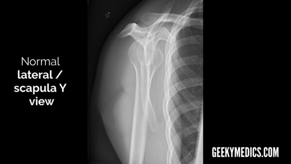 Normal shoulder X-ray lateral view