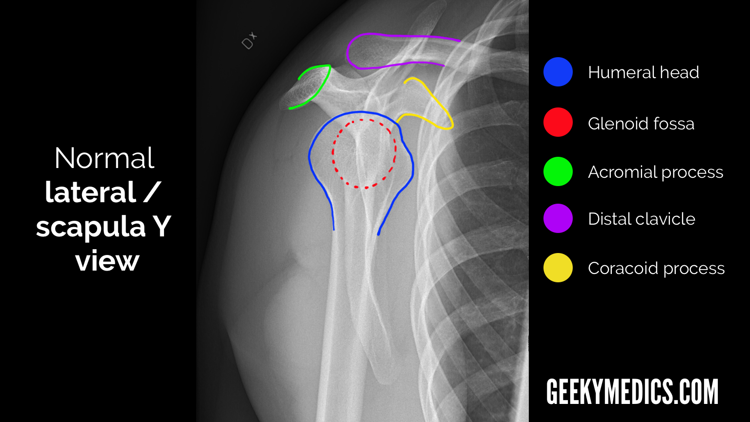 Shoulder X-ray Interpretation, Radiology
