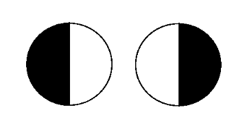 A diagram of bitemporal heminanopia