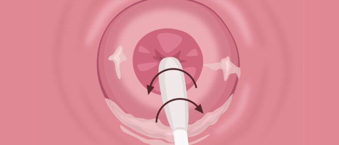 Rotate the swab for 10-15 seconds in the endocervix