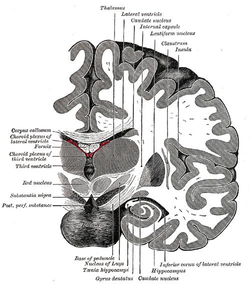  Coronal section of the brain