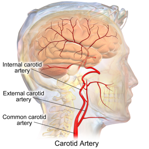  Carotid artery anatomy