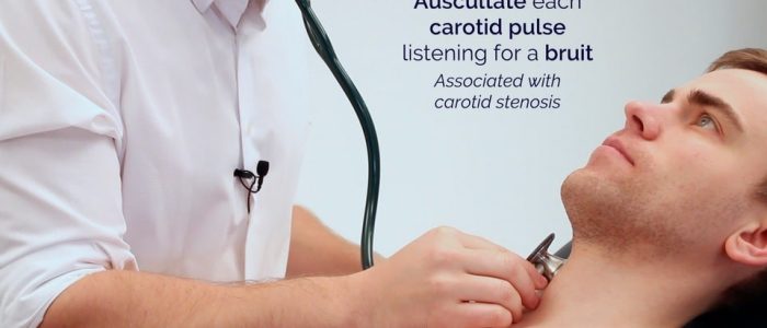 Carotid artery bruit