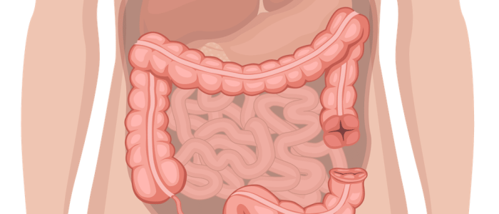A diagram of an end colostomy