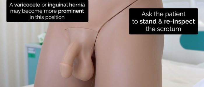 Inspect the scrotum with the patient standing