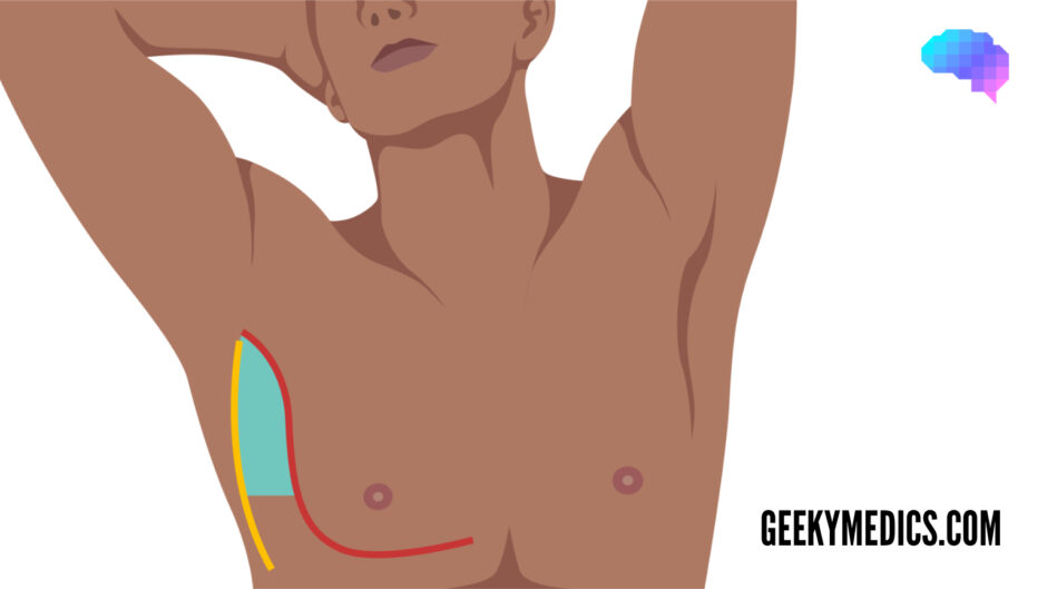 Chest drain position triangle
