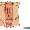 Abdominal surgical incisions