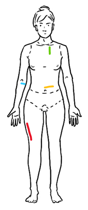 Examples of lesions and markings
