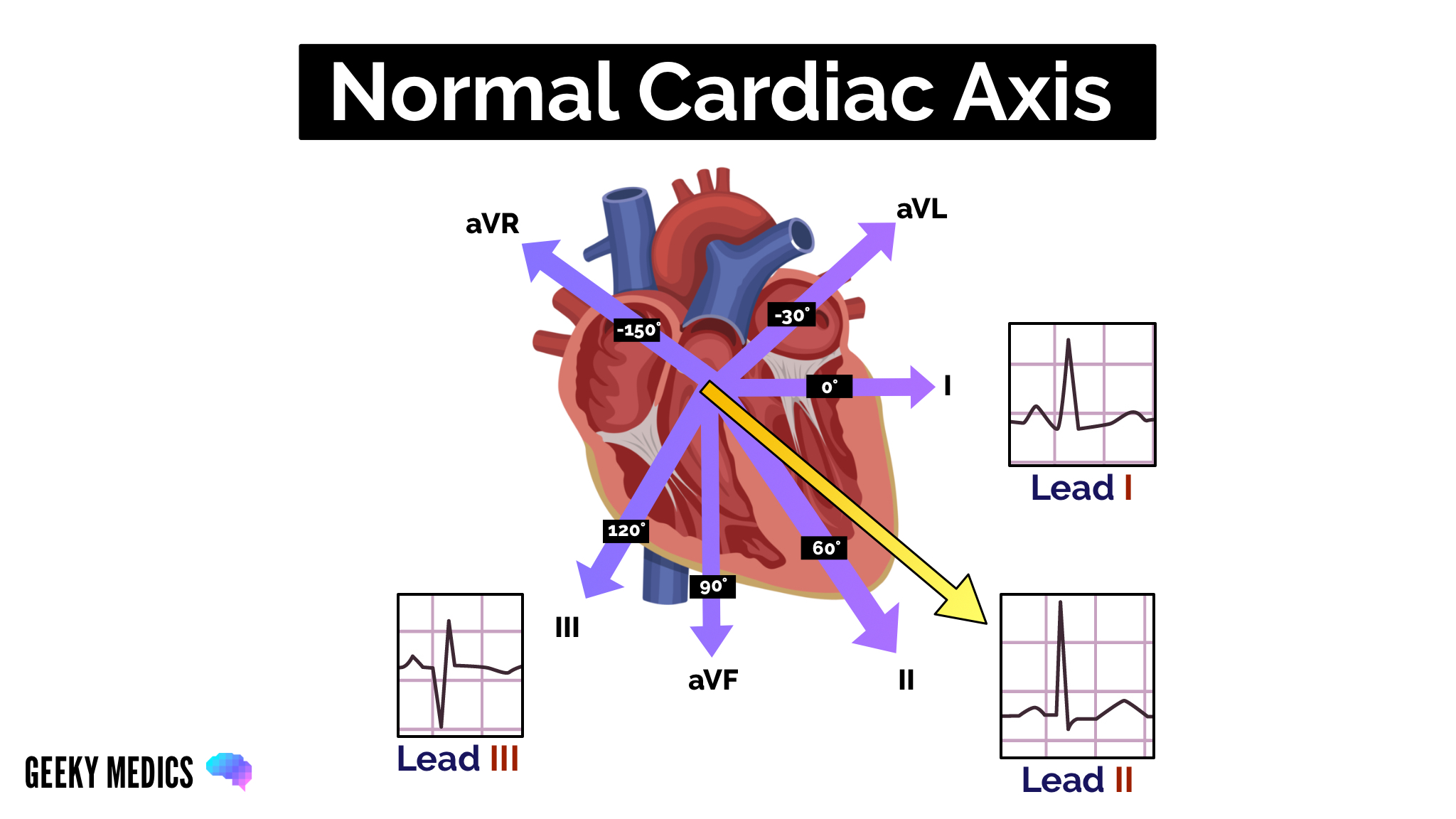 Normal Cardiac Axis