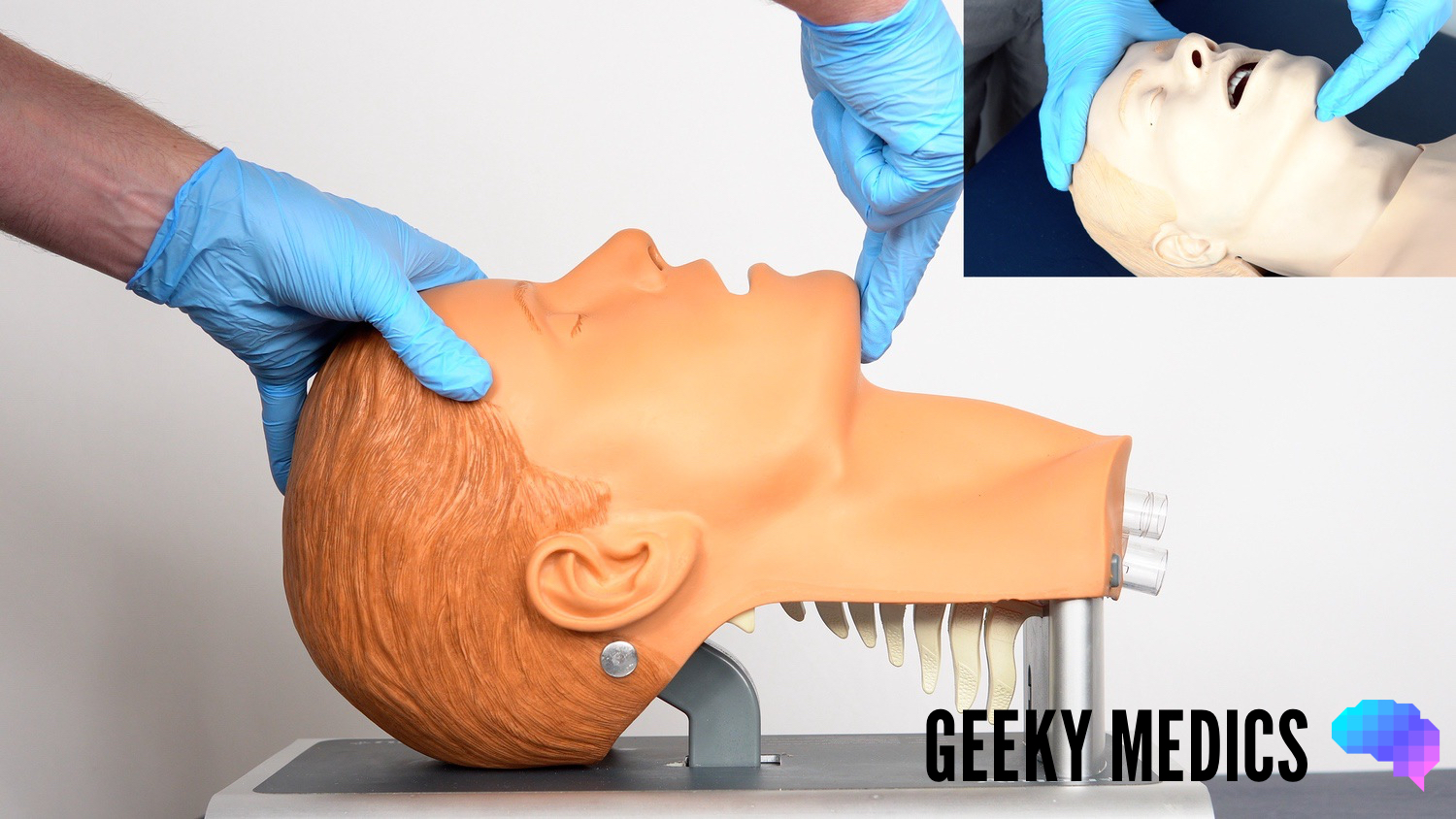 Basic Airway Manoeuvres – OSCE Guide
