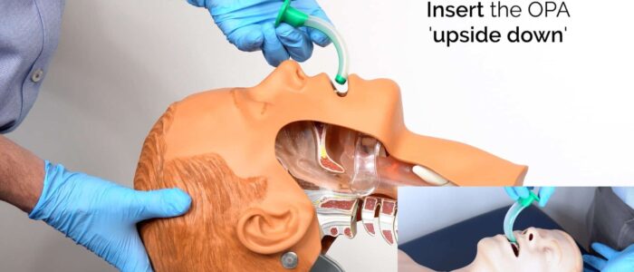 Oropharyngeal airway insertion
