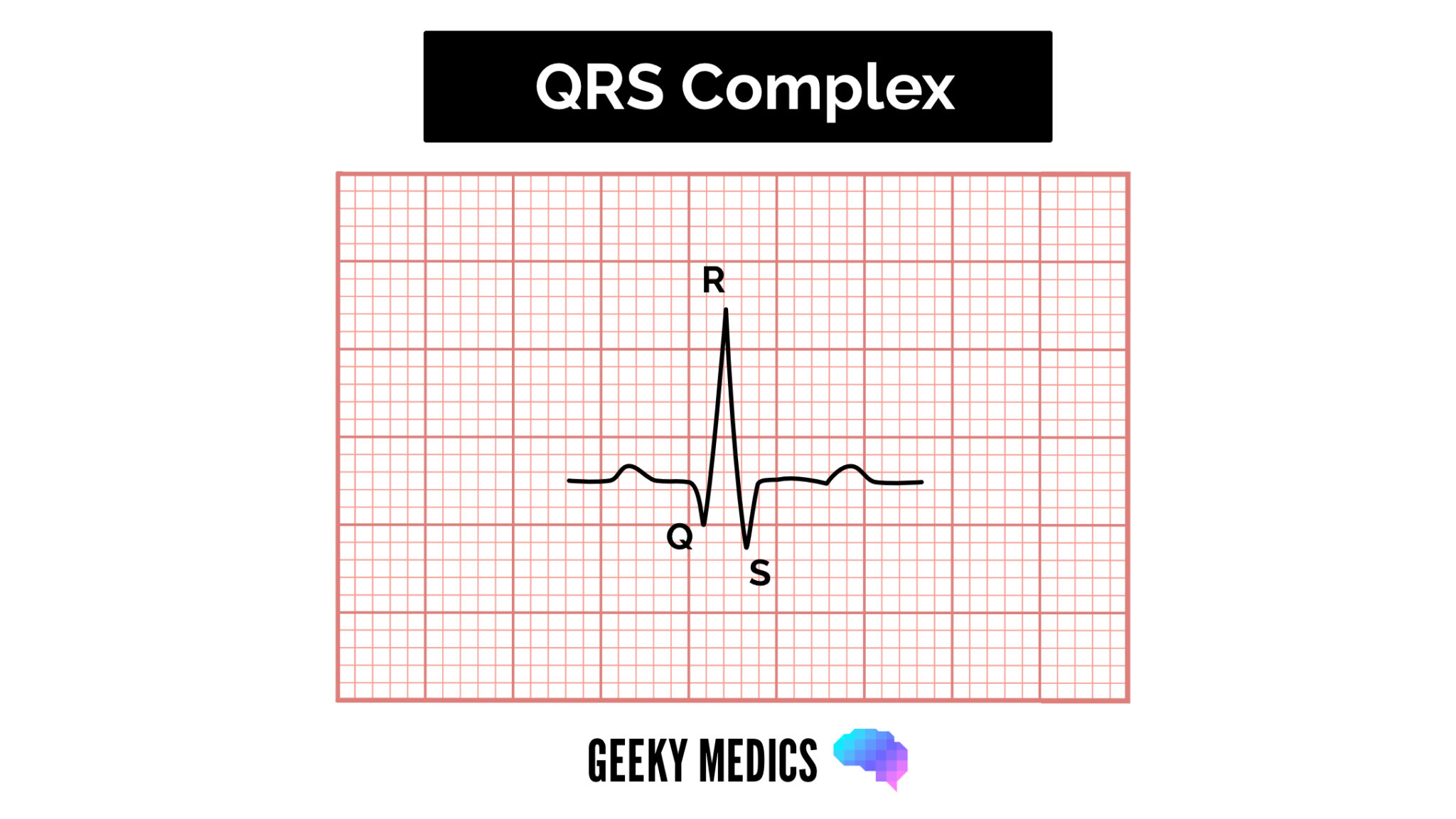 ECG - QRS Complex