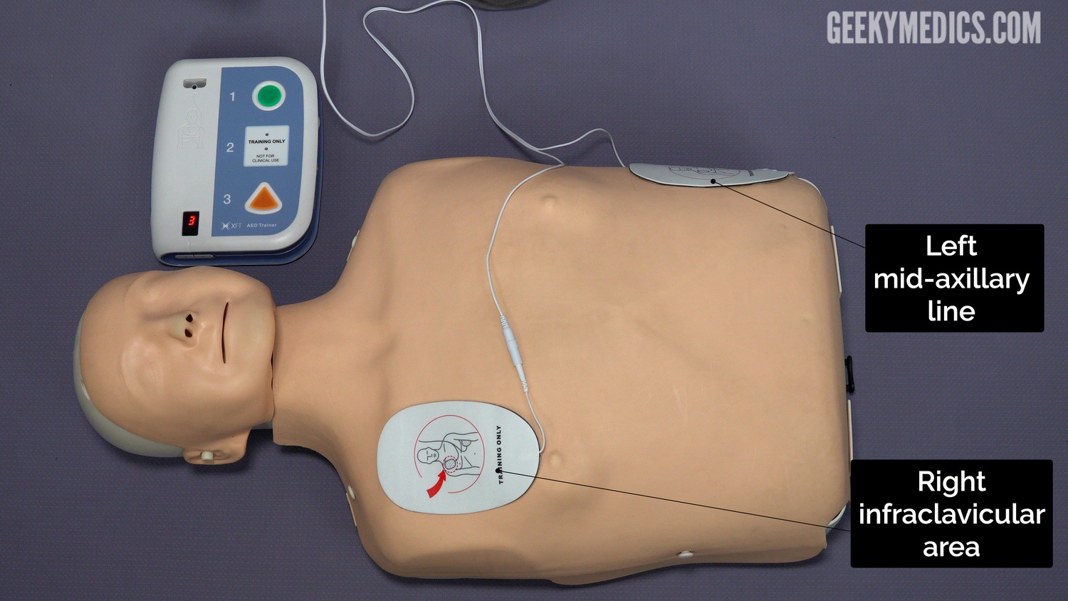 Attach the two self-adhesive pads immediately to the patient’s bare chest