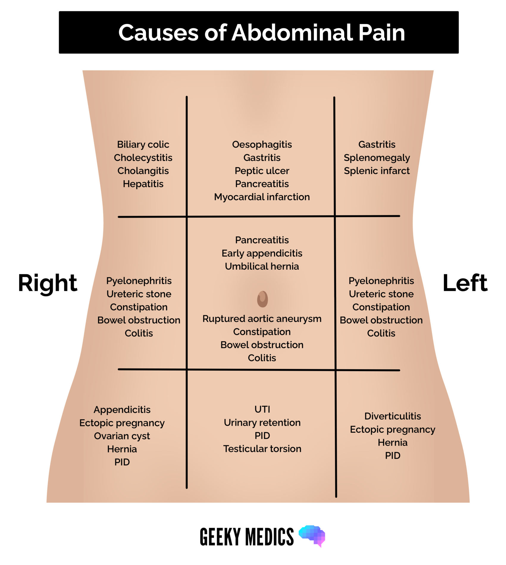 Causes of abdominal pain by location