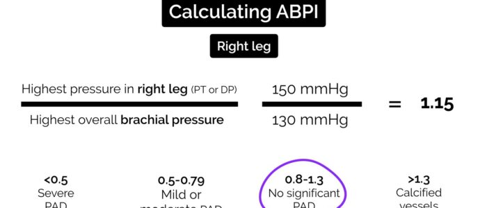 How to calculate the ankle brachial pressure index (ABPI)