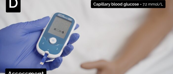 Consider measuring capillary blood glucose