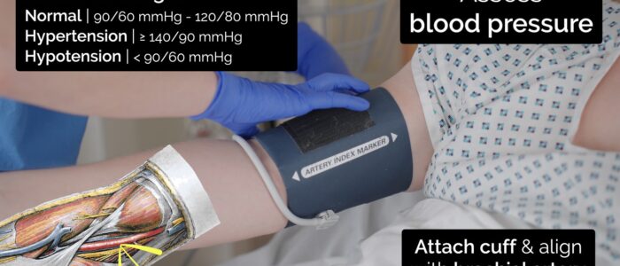 Measuring vital signs - assess blood pressure
