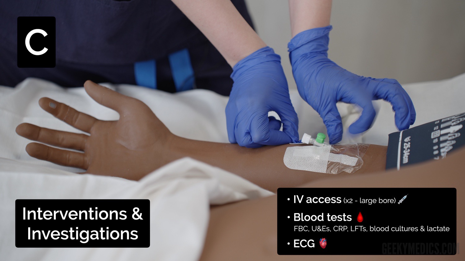 Consider IV access to facilitate fluid/drug administration & blood tests