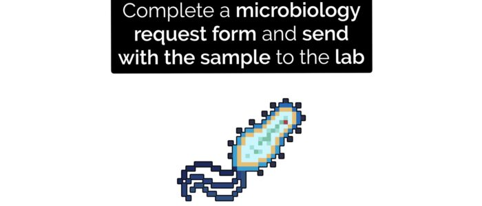 Sputum sample collection - complete a microbiology request form