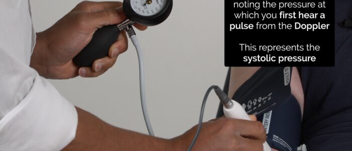 Deflate the cuff slowly, noting the pressure at which you first detect a pulse from the Doppler. This represents the systolic pressure in the vessel being assessed.