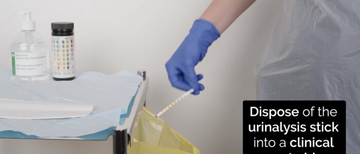 Urinalysis - dispose of urinalysis stick
