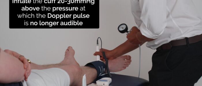 Inflate the cuff 20-30 mmHg above the pressure at which the Doppler pulse is no longer audible