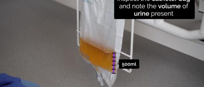 Measure urine volume