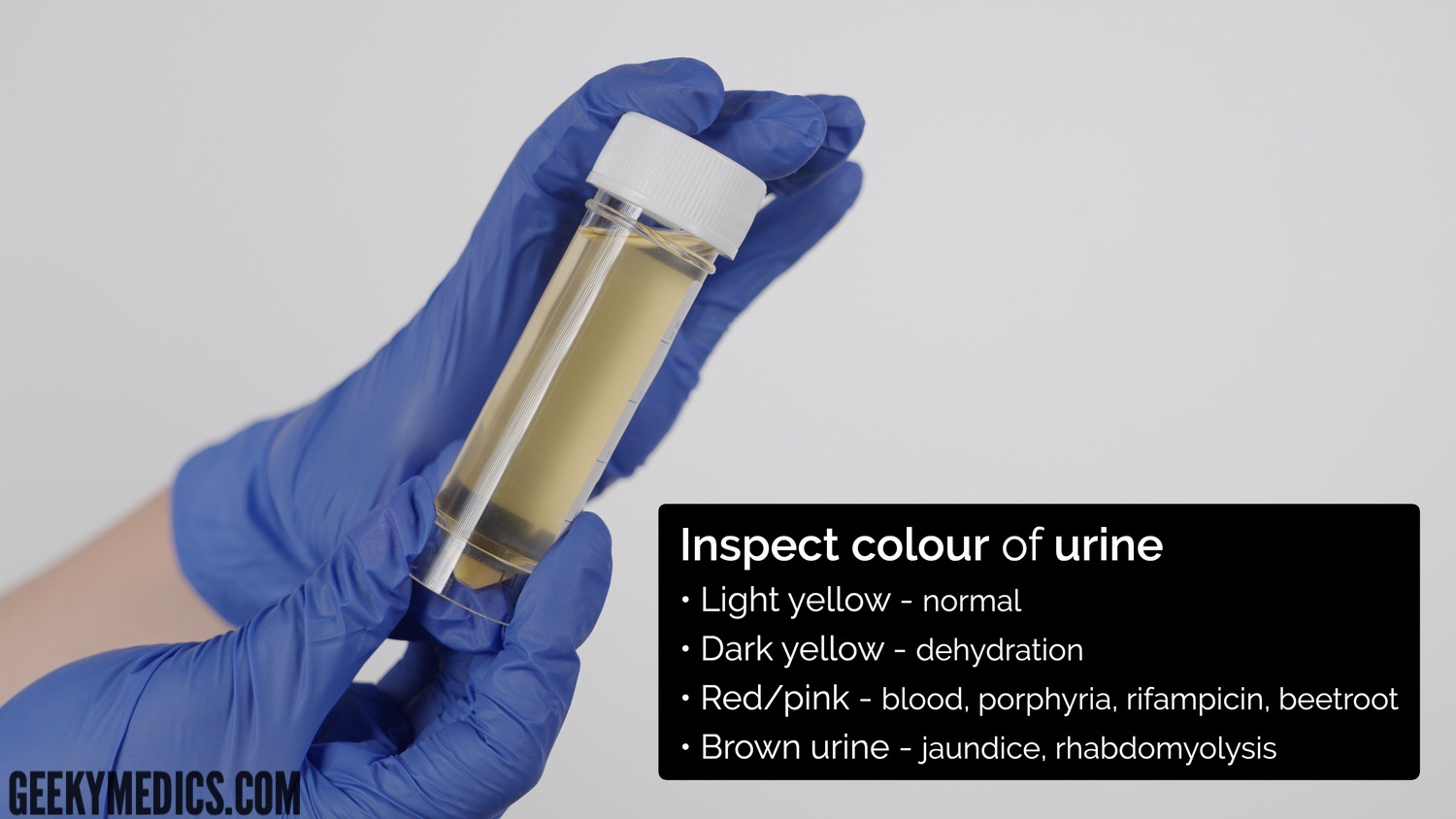 Urinalysis - inspect the colour of the urine
