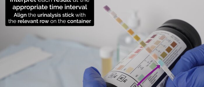 Urinalysis - Interpret each test at the appropriate time using the dipstick analysis chart