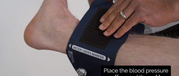 Place the sphygmomanometer on the left ankle