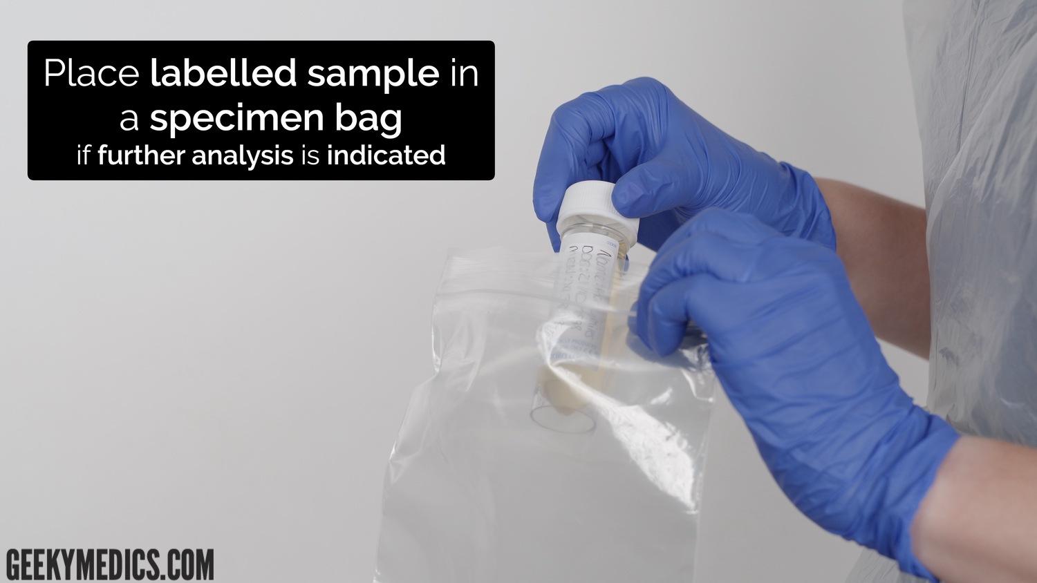 Urinalysis - place sample in specimen bag if required