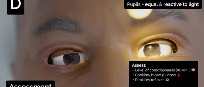 Assess pupillary reflexes