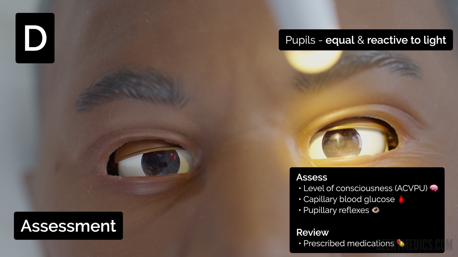 Assess pupillary reflexes