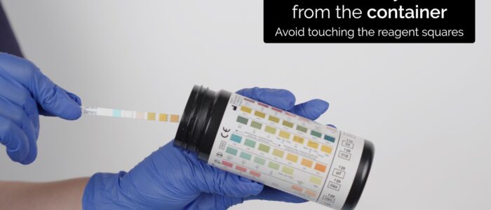 Urinalysis - Remove the testing strip from the container