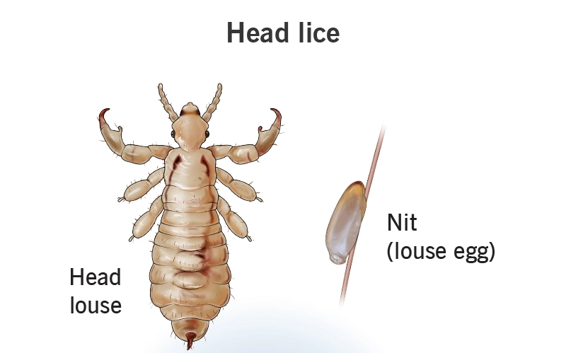 Head louse and egg (nit)