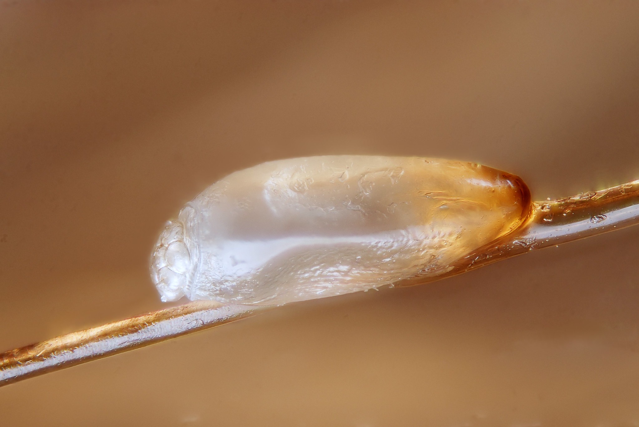Human head louse egg (nit)