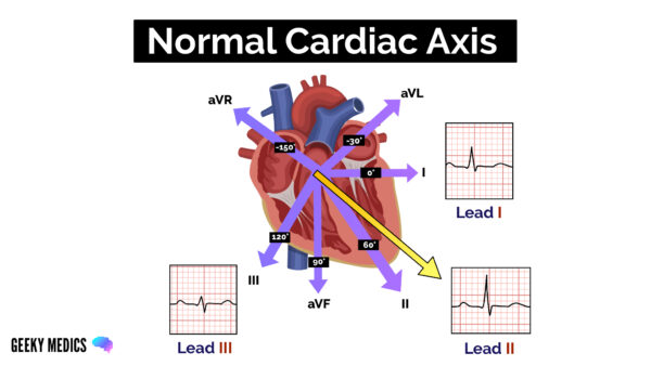 Normal Cardiac Axis
