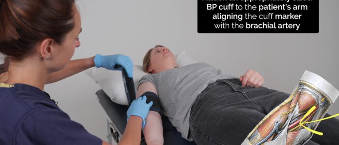 Lying and standing blood pressure: Attach the blood pressure cuff