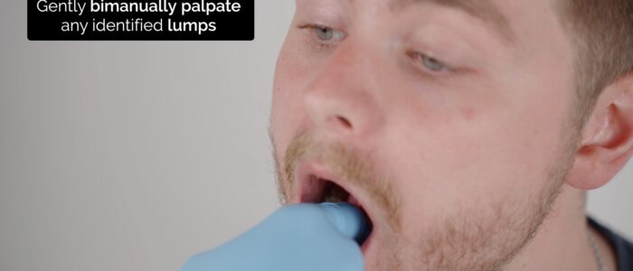 Oral cavity exam - Bimanual palpation