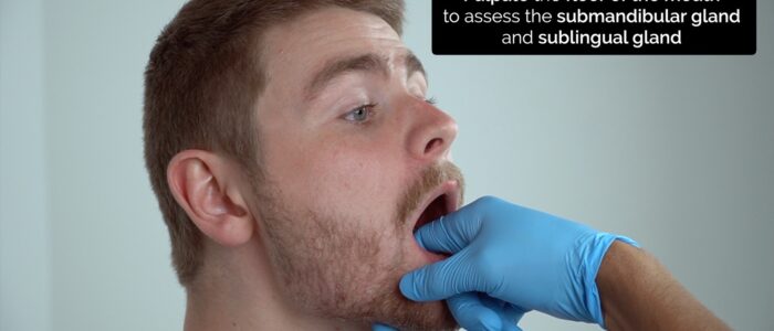 Oral cavity exam - Bimanual palpation