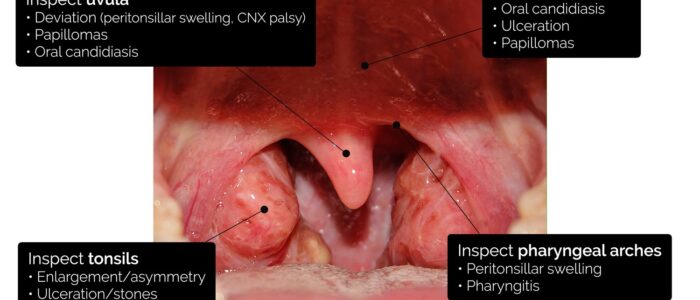 Oral cavity exam - Oral cavity anatomy