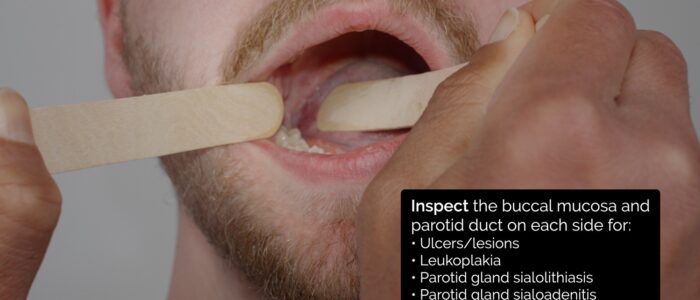 Oral cavity inspection - inspect the buccal mucosa
