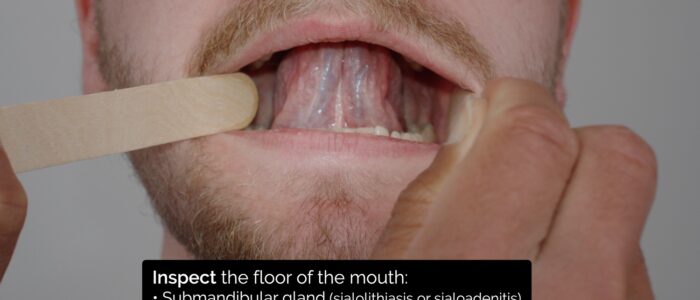 Oral cavity exam - inspect the floor of the mouth