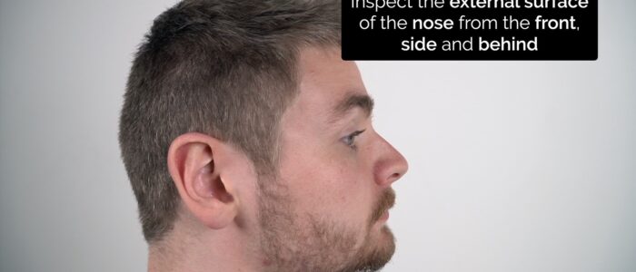 Inspect the external surface of the nose from the front, side and behind