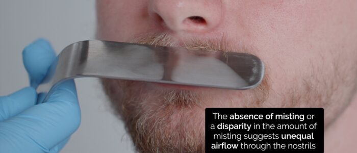 Nasal examination - assess nasal airflow