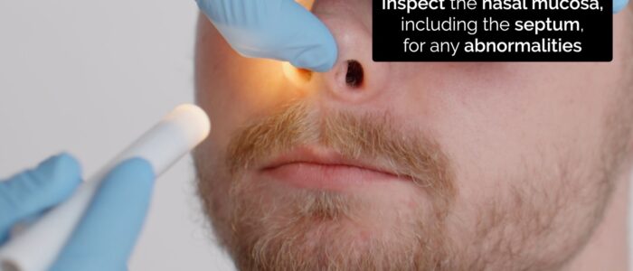 Nasal exam - nostril inspection of nasal mucosa