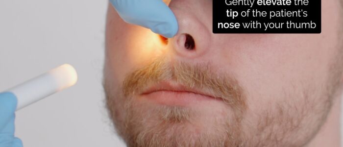 Nasal exam - nostril inspection