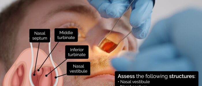 Nasal examination - inserting a thudicum