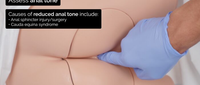 Rectal (PR) examination - Assess anal tone