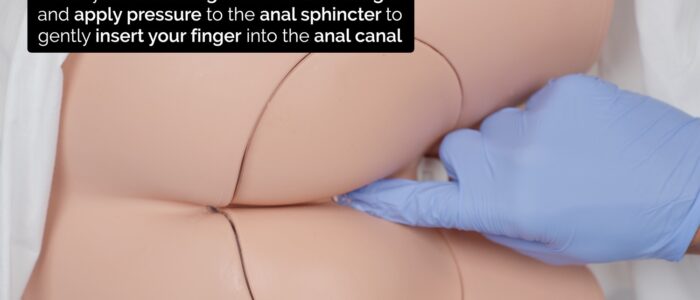 Rectal (PR) examination - Insert the finger gently into the anal canal